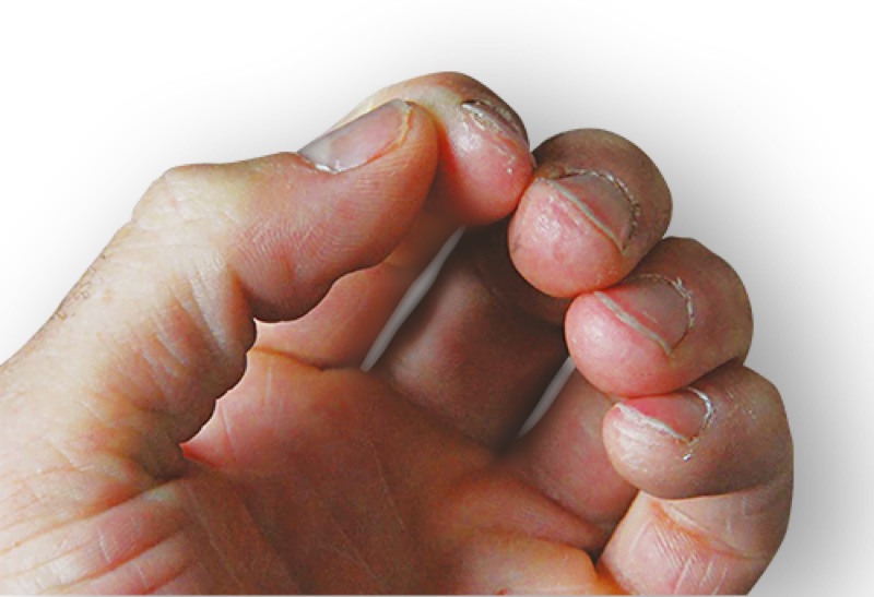 O'Keeffe's Working Hands result, before and after