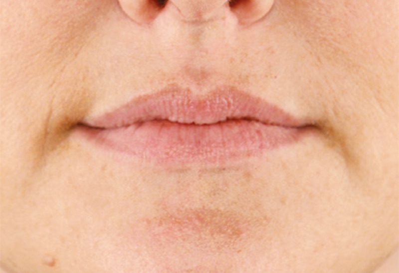 O'Keeffe's Lip Repair result